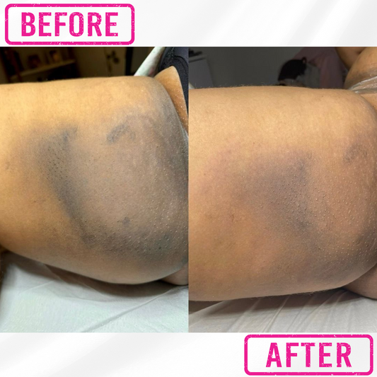 B Smooth & Bright Ingrown Hair Relief + Skin Brightening Solution