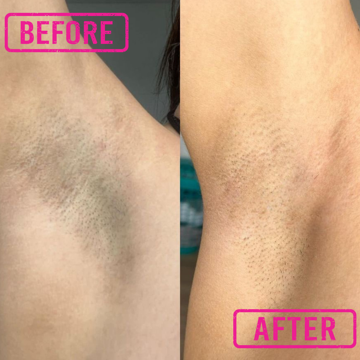 B Smooth & Bright Ingrown Hair Relief + Skin Brightening Solution